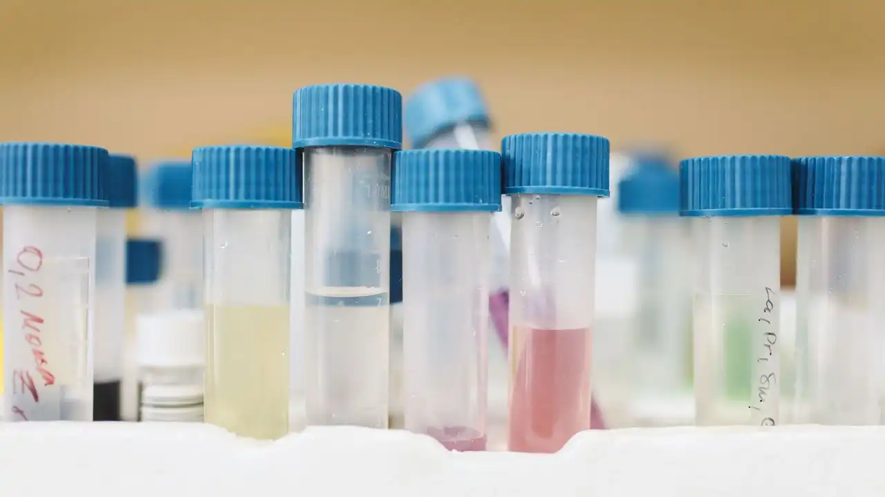 Prélèvement et analyse de l'eau d'une piscine avec un photomètre