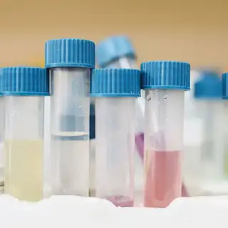 Prélèvement et analyse de l'eau d'une piscine avec un photomètre